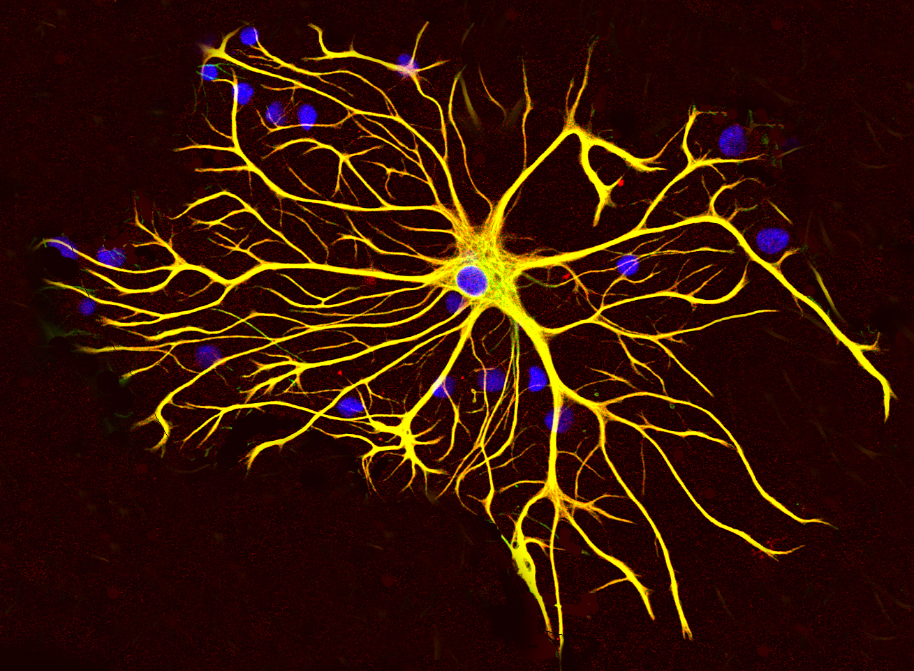 Fluorescence microscopy of a single cultured astrocyte, a star-shaped cell with many fine branching processes glowing against a dark background.