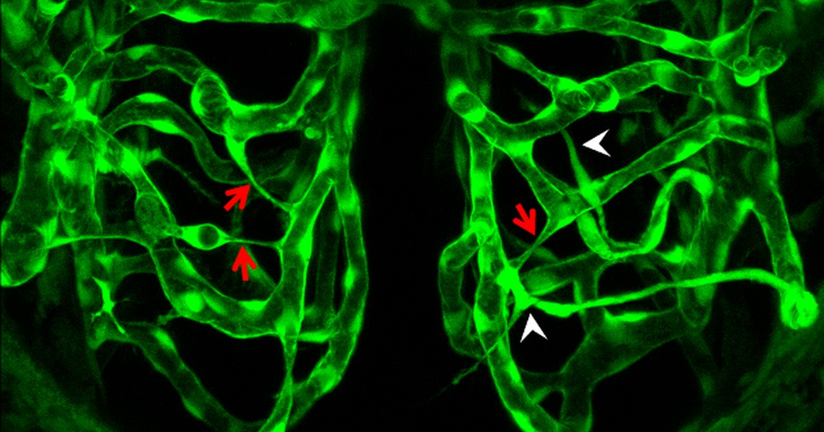 Fluorescence microscopy of brain blood vessels, a dense green branching network of arterioles and capillaries against a dark background.