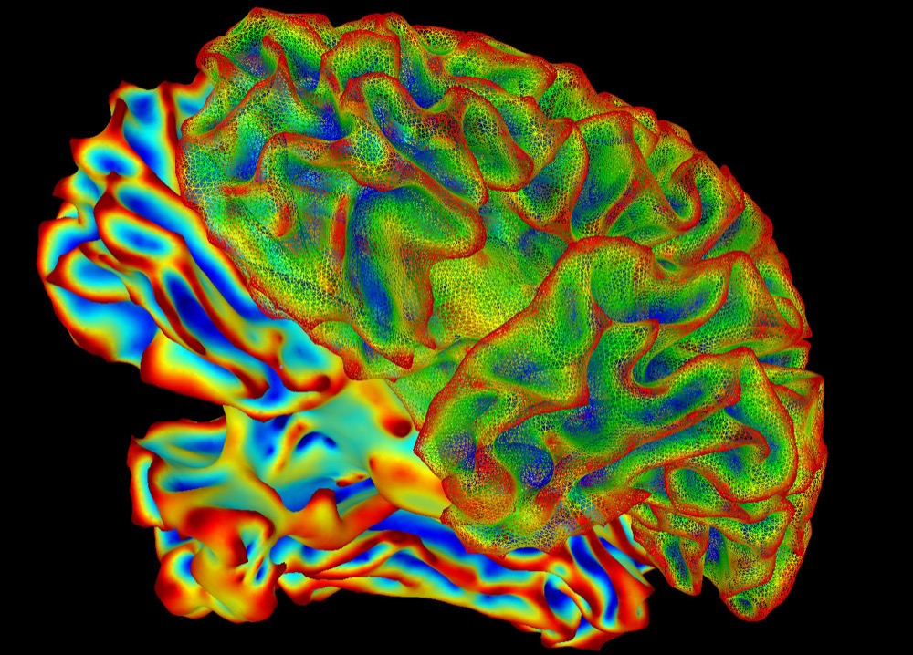 A colorful functional MRI visualization of a whole human brain, with activity mapped in many colors across the entire surface